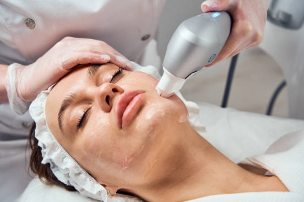 What To Expect After Microdermabrasion