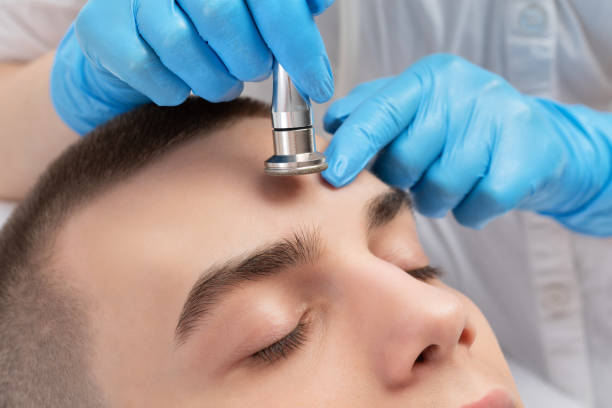 Who Is A Good Candidate For Dermabrasion